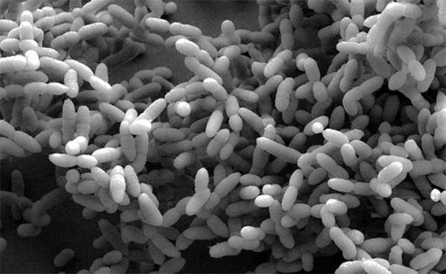 Methanobrevibacter Archaeon der Spezies Methanobrevibacter